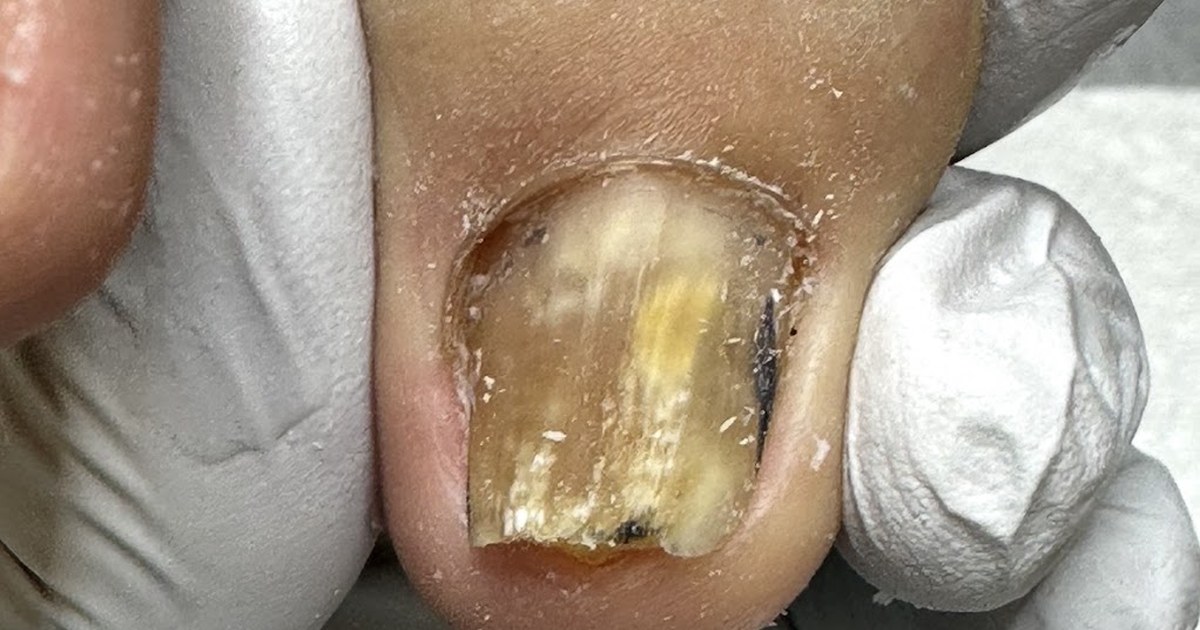 Berg Healthy Feet & Nails